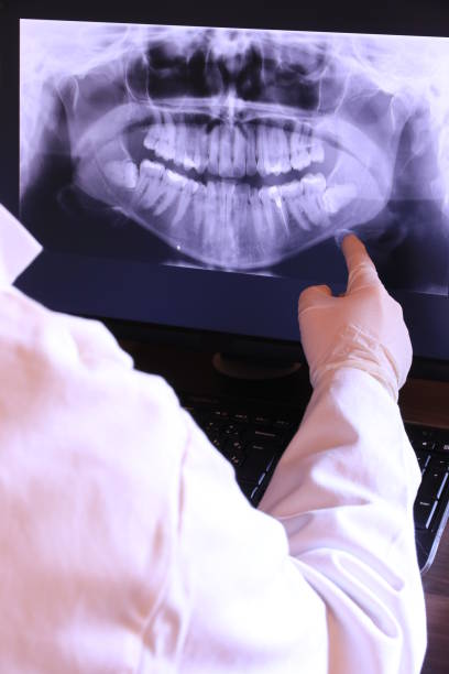 Best Emergency Dental Extractions in Willow, AK